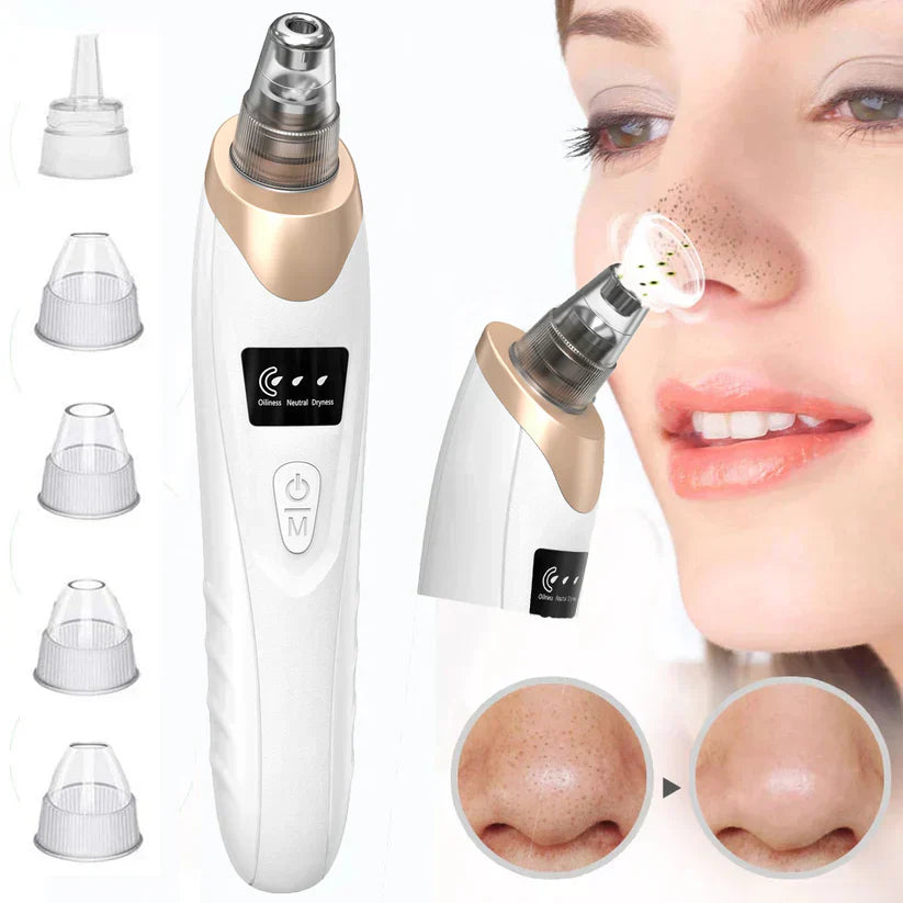 Premium Quality 5 IN 1 Blackheads Remover Vacuum Rechargable